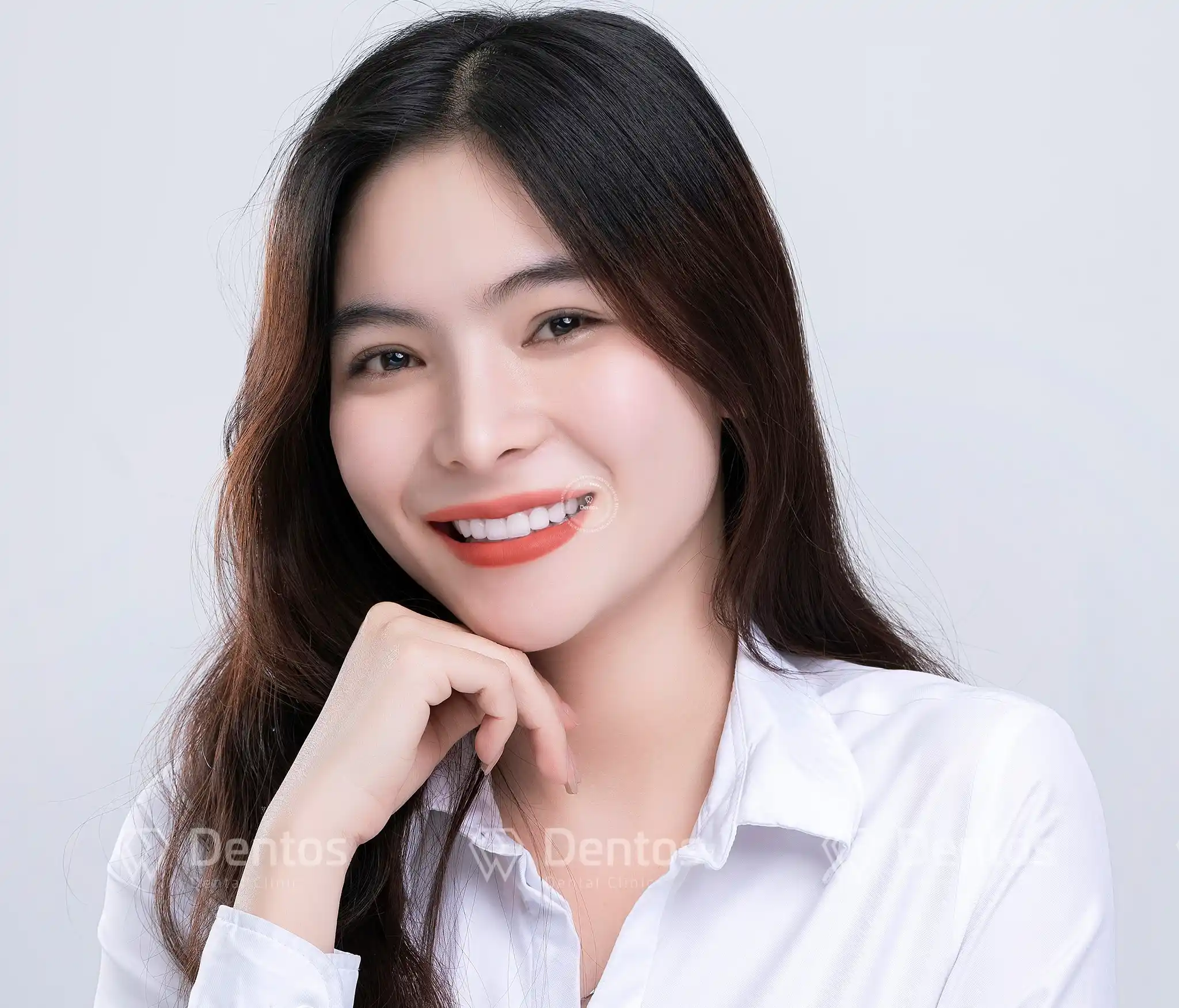 Vì sao răng toàn sứ được tin dùng? Răng toàn sứ giá bao nhiêu?